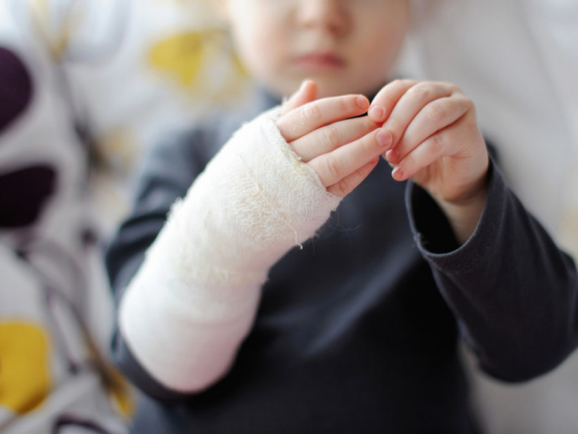 В Черкасской области дети проводили опыты с водкой и огнем: 8-летнего ребенка госпитализировали с ожогами