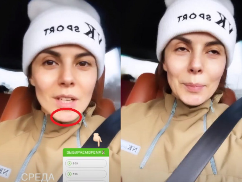С покраснениями и прыщиками на лице – Настя Каменских появилась без макияжа (ФОТО)