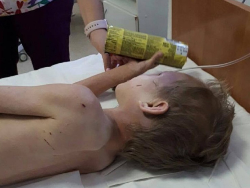 Колола иглами и била: В Днепре мать пытала приемного сына, ребенок попал в реанимацию (ФОТО)